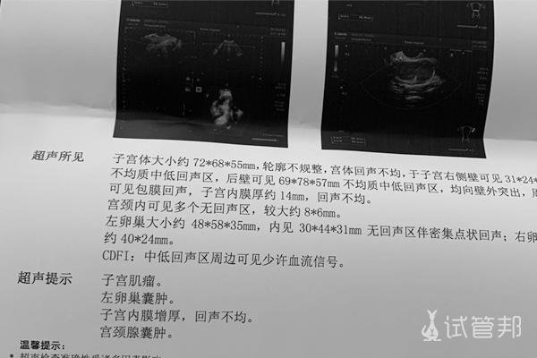 单角子宫是什么「男子检查发现有子宫肌瘤」 电动汽车配件